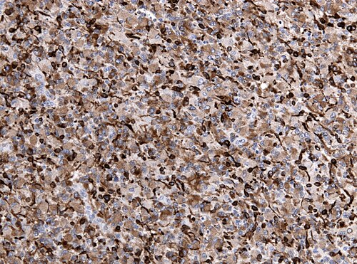 Neuropathology case IX 05.jpg