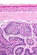 Thumbnail for version as of 02:16, 28 August 2009