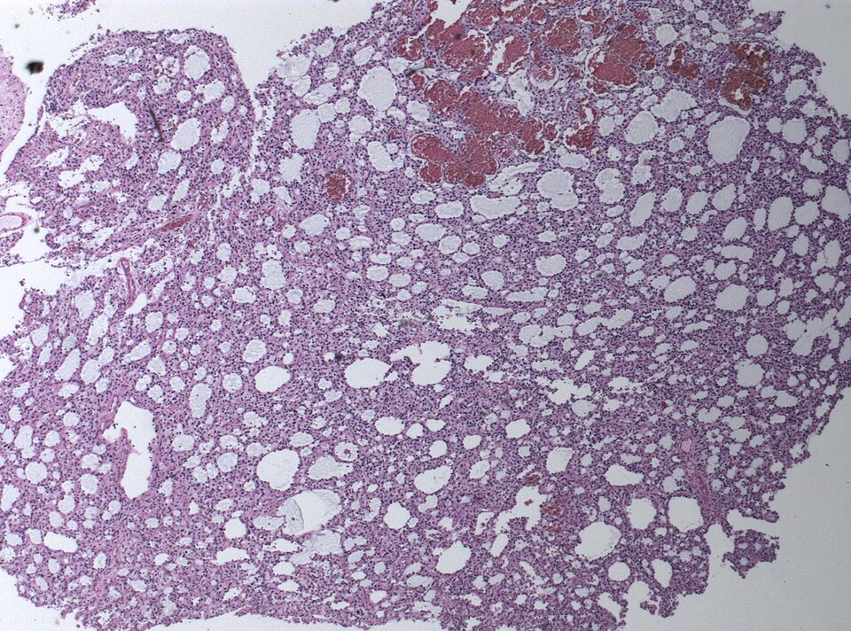 File:Neuropathology case II 01.jpg