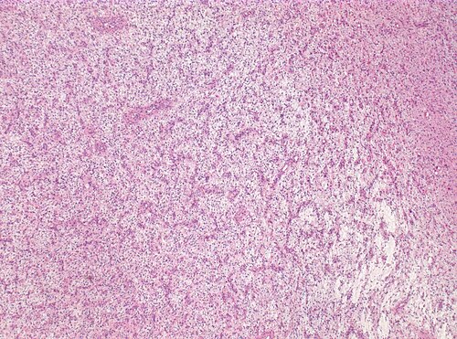 Neuropathology case V 01.jpg